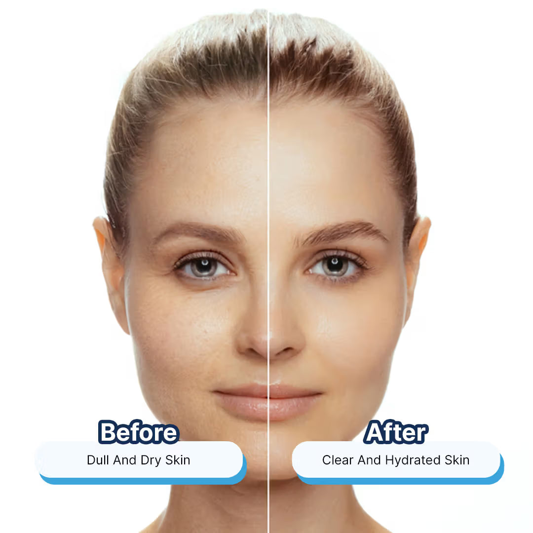 Hydra Glow Skincare Aloe Gel Moist Hydrating and Nourishing Moisturizer (100ml)